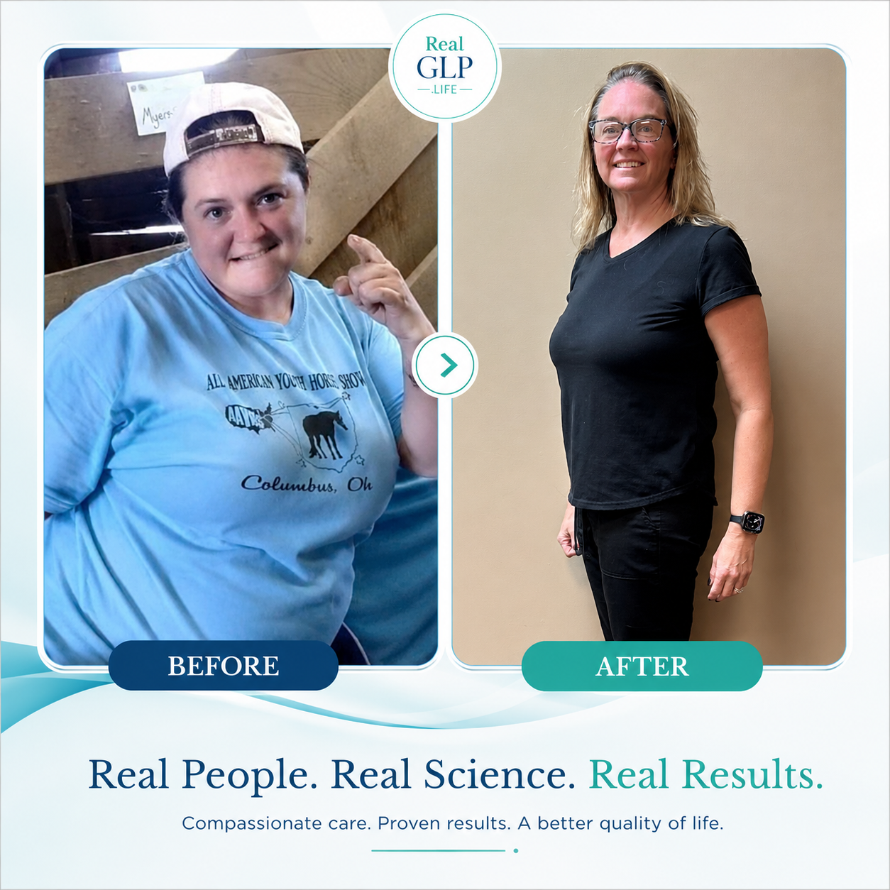 Angela Jayes, NP before and after health journey photo